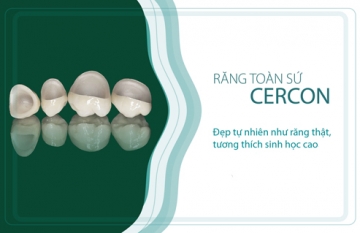 Những ưu điểm của răng sứ Cercon Zirconia