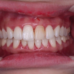 Thẩm mỹ răng