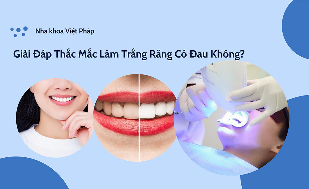 Giải Đáp Thắc Mắc Làm Trắng Răng Có Đau Không?