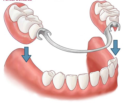 Mô hình bộ răng người lớn